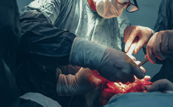 Oral Cancer